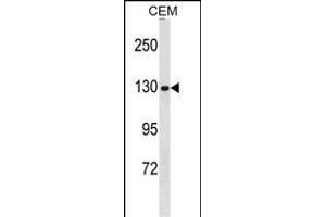 NCAPG anticorps  (N-Term)