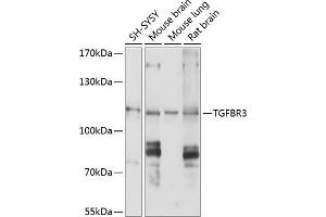 Western blot analysis of extracts of various cell lines, using TGFBR3 antibody (ABIN1683014, ABIN5663727, ABIN5663729 and ABIN6213905) at 1:1000 dilution. (TGFBR3 antibody  (AA 140-340))