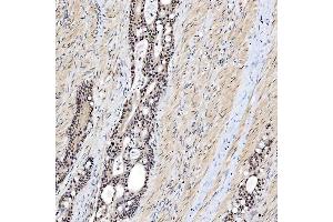 IHC analysis of SNRNP200 using anti-SNRNP200 antibody (ABIN7602032). (SNRNP200 antibody  (AA 557-2129))
