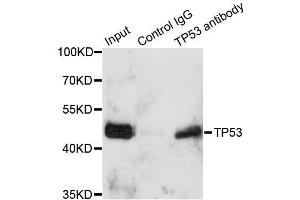 Immunoprecipitation analysis of 150ug extracts of A549 cells using 3ug TP53 antibody. (p53 antibody  (AA 1-100))