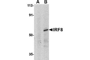 Western Blotting (WB) image for anti-Interferon Regulatory Factor 8 (IRF8) (C-Term) antibody (ABIN1030453) (IRF8 antibody  (C-Term))