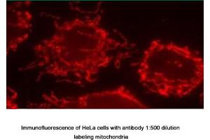 Image no. 1 for anti-Inner Membrane Protein, Mitochondrial (IMMT) antibody (ABIN363364) (IMMT antibody)