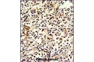 Formalin-fixed and paraffin-embedded human lymph reacted with PCM-1 Antibody (C-term), which was peroxidase-conjugated to the secondary antibody, followed by DAB staining. (PCM1 antibody  (C-Term))
