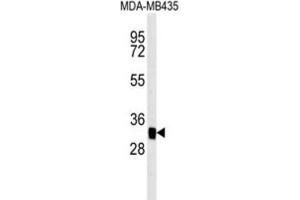Western Blotting (WB) image for anti-Mitochondrial Carrier 2 (MTCH2) antibody (ABIN3002367) (MTCH2 antibody)