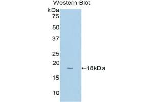 Detection of Recombinant CYP1B1, Human using Polyclonal Antibody to Cytochrome P450 1B1 (CYP1B1) (CYP1B1 antibody  (AA 374-516))