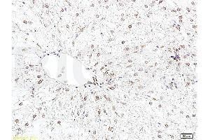 Formalin-fixed and paraffin embedded rat liver tissue labeled with Anti-Bcl-2 Polyclonal Antibody, Unconjugated (ABIN723920) 1:400 followed by conjugation to the secondary antibody and DAB staining (Bcl-2 antibody  (AA 101-160))