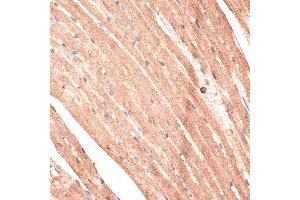 Immunohistochemistry (Paraffin-embedded Sections) (IHC (p)) image for anti-Kinectin 1 (Kinesin Receptor) (KTN1) (AA 1-100) antibody (ABIN6143045)