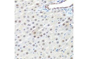 Immunohistochemistry of paraffin-embedded rat liver using PRPF19 antibody (ABIN6293423) at dilution of 1:100 (40x lens). (PRP19 antibody)