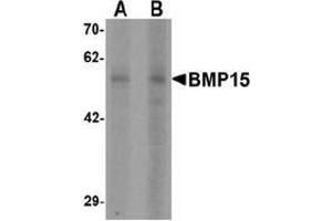 Western blot analysis of BMP15 in 3T3 cell lysate with BMP15 Antibody  at (A) 1 and (B) 2 µg/ml (BMP15 antibody  (N-Term))