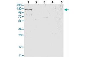 Western blot analysis of Lane 1: RT-4, Lane 2: U-251 MG, Lane 3: Human Plasma, Lane 4: Liver, Lane 5: Tonsil with RBM33 polyclonal antibody  at 1:250-1:500 dilution. (RBM33 antibody)