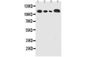 Anti-human CEACAM5 antibody, Western blotting Lane 1: Recombinant Human CEA Protein 5ng Lane 2: Recombinant Human CEA Protein 2