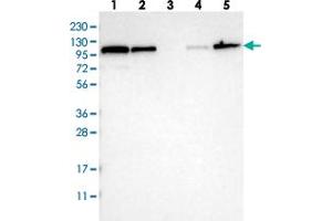 Western blot analysis of Lane 1: RT-4, Lane 2: U-251 MG, Lane 3: Human Plasma, Lane 4: Liver, Lane 5: Tonsil with STRN polyclonal antibody  at 1:250-1:500 dilution. (Striatin antibody)