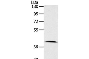 Western Blot analysis of Human lymphoma tissue using CDK10 Polyclonal Antibody at dilution of 1:100 (CDK10 antibody)