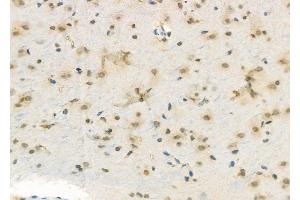 ABIN6263269 and ABIN6272345 at 1/100 staining Rat brain tissue by IHC-P.
