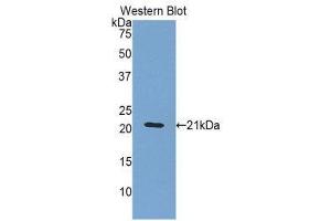Western Blotting (WB) image for anti-Orosomucoid 1 (ORM1) (AA 20-186) antibody (ABIN3207789) (ORM1 antibody  (AA 20-186))