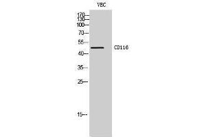 Western Blotting (WB) image for anti-Colony Stimulating Factor 2 Receptor, Alpha, Low-Affinity (Granulocyte-Macrophage) (CSF2RA) (Internal Region) antibody (ABIN3174234) (CSF2RA antibody  (Internal Region))