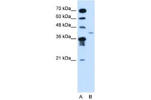 MFAP3L antibody used at 2.