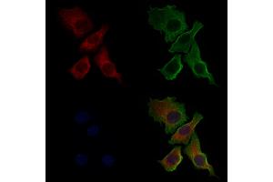 ABIN6261127 and ABIN6268827 staining Hela cells by IF/ICC.
