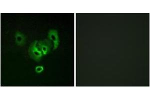 Immunofluorescence analysis of A549 cells, using STEA2 Antibody. (STEAP2 antibody  (AA 431-480))