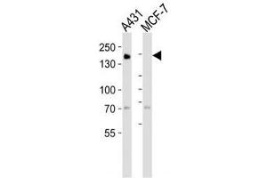 Western blot analysis of lysate from A431, MCF-7 cell line (left to right) using EGF Receptor antibody at 1:1000 for each lane. (EGFR antibody  (AA 1163-1191))