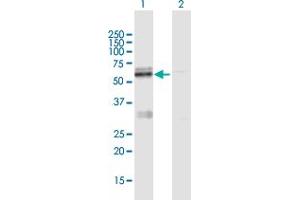 Western Blot analysis of LMF1 expression in transfected 293T cell line by LMF1 MaxPab polyclonal antibody. (LMF1 antibody  (AA 1-567))