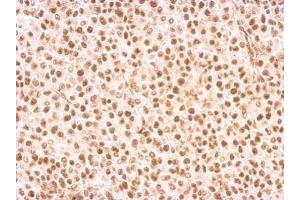 IHC-P Image Rad9 antibody detects RAD9A protein at nucleus on HBL435 xenograft by immunohistochemical analysis. (RAD9A antibody  (Center))