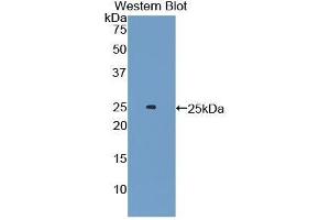 Western Blotting (WB) image for anti-Androgen Receptor (AR) (AA 491-679) antibody (ABIN1174429)