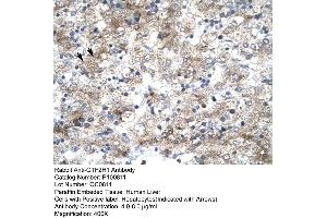 Human Liver (GTF2H1 antibody  (N-Term))