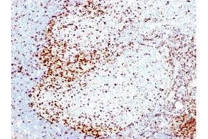 Formalin-fixed, paraffin-embedded human Tonsil stained with ZAP70 Mouse Monoclonal Antibody (2F3. (ZAP70 antibody  (AA 1-254))