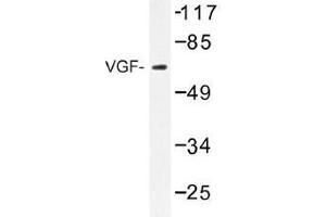 Image no. 1 for anti-VGF Nerve Growth Factor Inducible (VGF) antibody (ABIN317924) (VGF antibody)