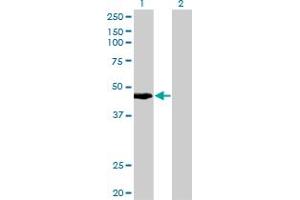 Western Blot analysis of KRTHA4 expression in transfected 293T cell line by KRTHA4 monoclonal antibody (M10), clone 3E5. (Keratin 34 antibody  (AA 337-436))