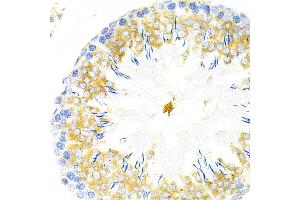 Immunohistochemistry of paraffin-embedded rat testis using TAPBP Antibody (ABIN6132745, ABIN6148848, ABIN6148850 and ABIN6219122) at dilution of 1:200 (40x lens).