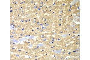 Immunohistochemistry of paraffin-embedded Mouse heart using RPH3A Polyclonal Antibody at dilution of 1:100 (40x lens). (RPH3A antibody)