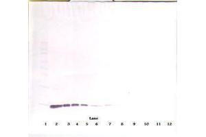 Image no. 1 for anti-Interleukin 2 (IL2) antibody (ABIN465098) (IL-2 antibody)