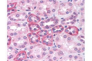 Immunohistochemistry (IHC) image for anti-SRY (Sex Determining Region Y)-Box 2 (SOX2) (N-Term) antibody (ABIN2777428) (SOX2 antibody  (N-Term))
