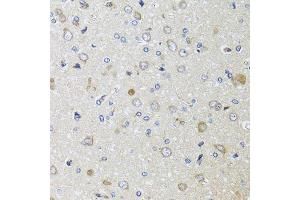 Immunohistochemistry of paraffin-embedded rat brain using B2M antibody. (beta-2 Microglobulin antibody  (AA 21-119))