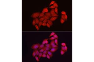Immunofluorescence analysis of HeLa cells using NUR77 Rabbit pAb (ABIN6134860, ABIN6144825, ABIN6144828 and ABIN6217265) at dilution of 1:50 (40x lens). (NR4A1 antibody)
