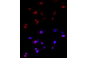 Immunofluorescence (IF) image for anti-Myeloid/lymphoid Or Mixed-Lineage Leukemia (MLL) antibody (ABIN6142981)