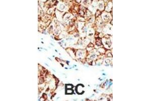 Immunohistochemistry (IHC) image for anti-Ubiquilin 1 (UBQLN1) antibody (ABIN2995228) (Ubiquilin 1 antibody)
