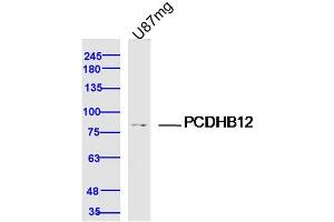U87MG lysates probed with PCDHB12 Polyclonal Antibody, Unconjugated  at 1:300 dilution and 4˚C overnight incubation. (PCDHB12 antibody  (AA 121-220))