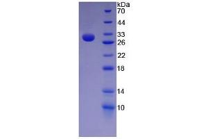 SDS-PAGE (SDS) image for Nestin (NES) ELISA Kit (ABIN6574161)