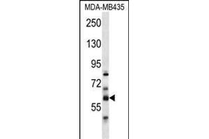 PTDSS2 Antibody (N-term) (ABIN656975 and ABIN2846159) western blot analysis in MDA-M cell line lysates (35 μg/lane).