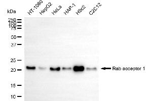 Western blotting analysis using rab acceptor 1 antibody (ABIN7800086).