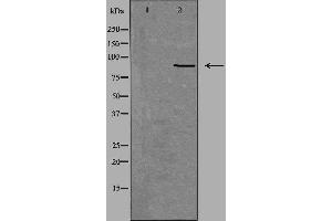 Western blot analysis of extracts from Jurkat cells, using NOX5 antibody. (NOX5 antibody  (C-Term))