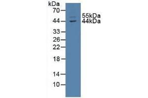 Detection of TXNIP in Mouse Intestine Tissue using Polyclonal Antibody to Thioredoxin-interacting Protein (TXNIP) (TXNIP antibody  (AA 30-381))