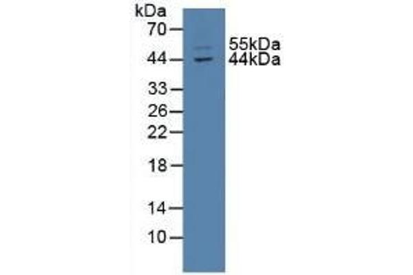 TXNIP Antikörper  (AA 30-381)