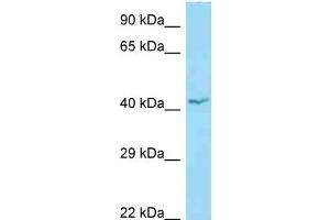 WB Suggested Anti-APOL1 Antibody Titration: 1. (APOL1 antibody  (N-Term))