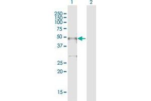 Western Blot analysis of TTC5 expression in transfected 293T cell line by TTC5 MaxPab polyclonal antibody. (TTC5 antibody  (AA 1-440))