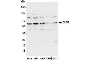 anti-Dihydrouridine Synthase 2-Like (DUS2L) (AA 443-493) antibody