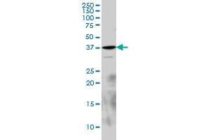 EPM2A monoclonal antibody (M02), clone 6C6 Western Blot analysis of EPM2A expression in PC-12 . (EPM2A antibody  (AA 101-199))
